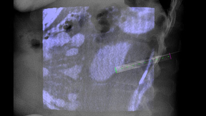 Gu&iacute;a de la trayectoria en vivo con XperGuide