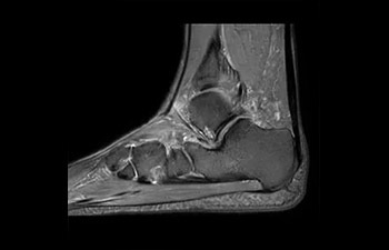 Sistema musculoesquel&eacute;tico