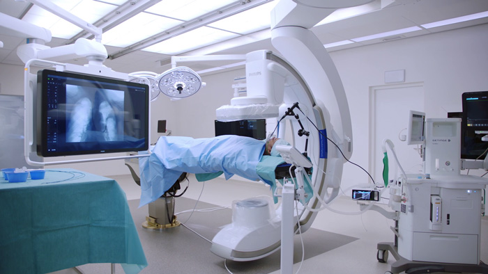 Acceso femoral para la cardiopat&iacute;a estructural (structural heart disease, SHD)