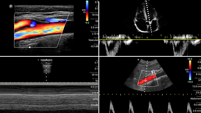 Imagen del primer caso