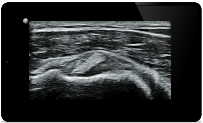 Iniciar el tratamiento con un diagn&oacute;stico preciso