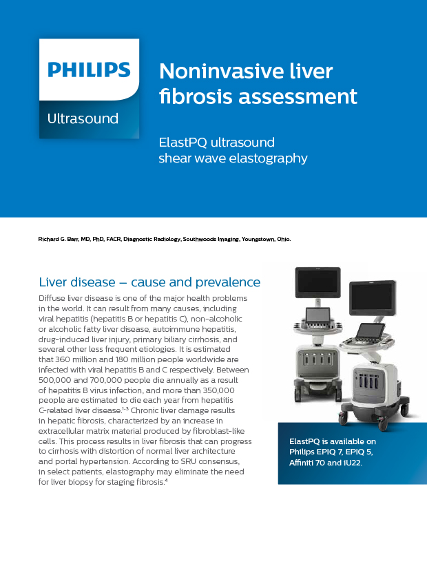 ElastPQ ultrasound shear wave elastography
