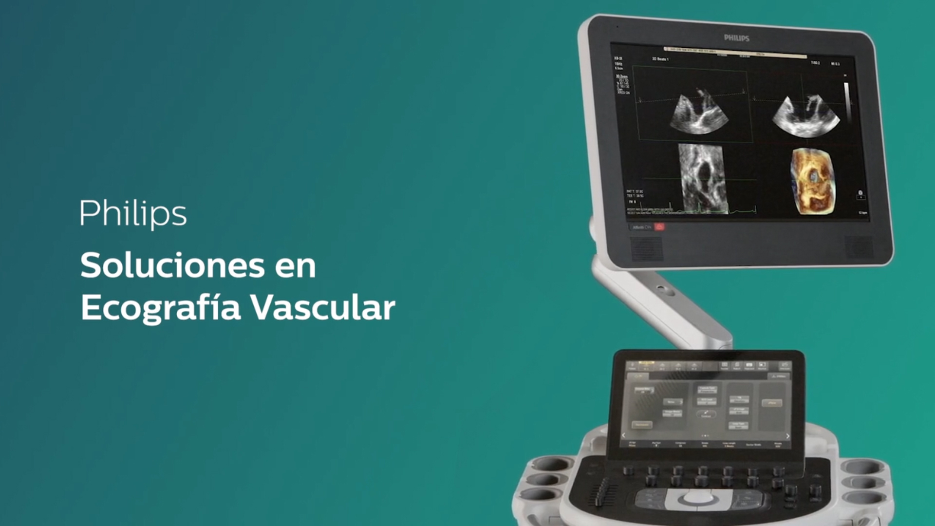 Philips Ecograf&iacute;a Vascular