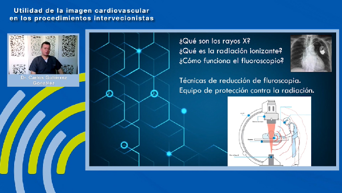 Buenas pr&aacute;cticas en el uso de la Fluoroscopia en la sala de Electrofisiolog&iacute;a cardiaca &ndash; Dr. Carlos Gutierrez Gonz&aacute;lez