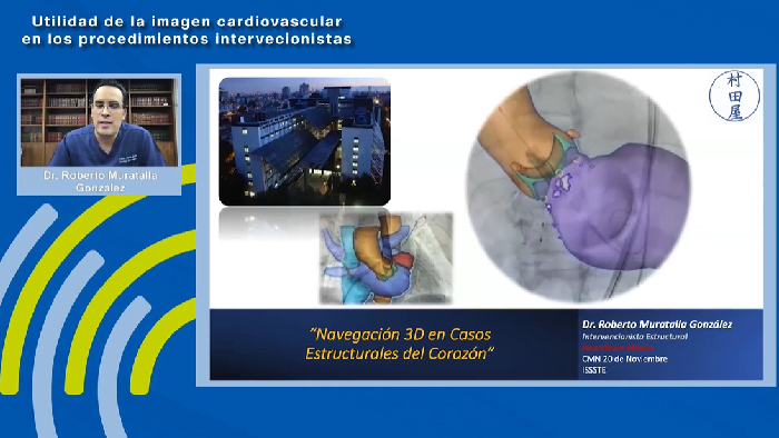 Navegaci&oacute;n 3D en casos estructurales del coraz&oacute;n - Dr. Roberto Muratalla Gonz&aacute;lez
