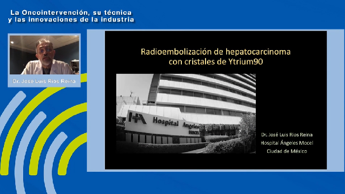 Radioembolizaci&oacute;n de hepatocarcinoma con cristales de Ytrium 90 &ndash; Dr. Jos&eacute; Luis Rios Reina