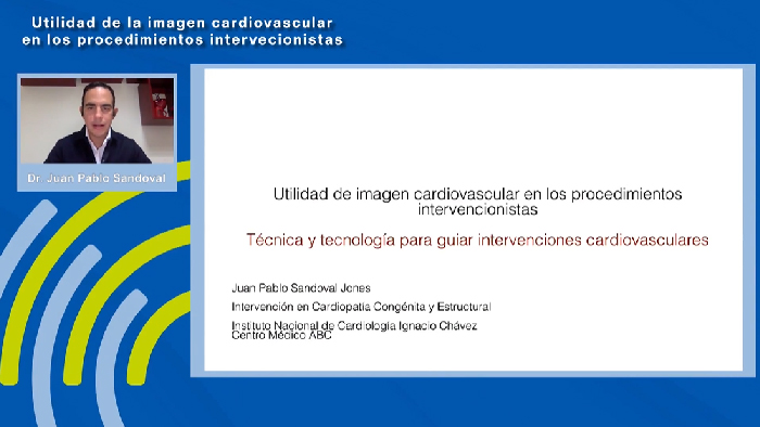 T&eacute;cnica y Tecnolog&iacute;a para guiar intervenciones cardiovasculares - Dr. Juan Pablo Sandoval