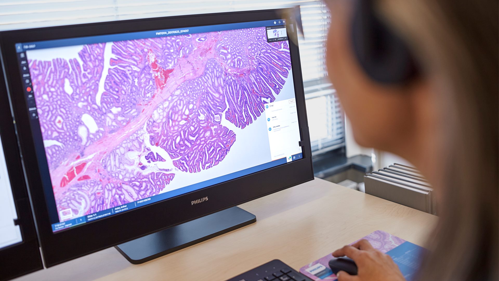 digital pathology