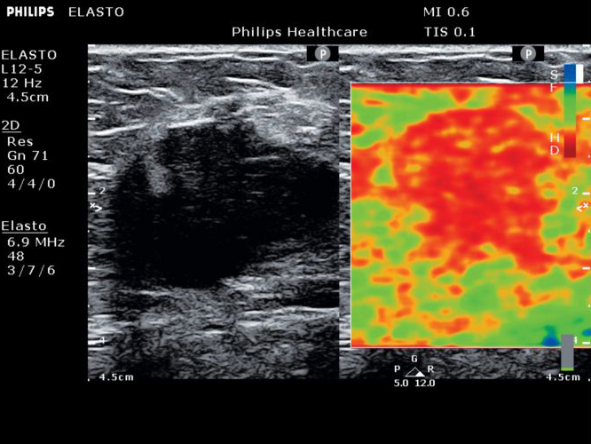 un primer plano de una ecograf&iacute;a