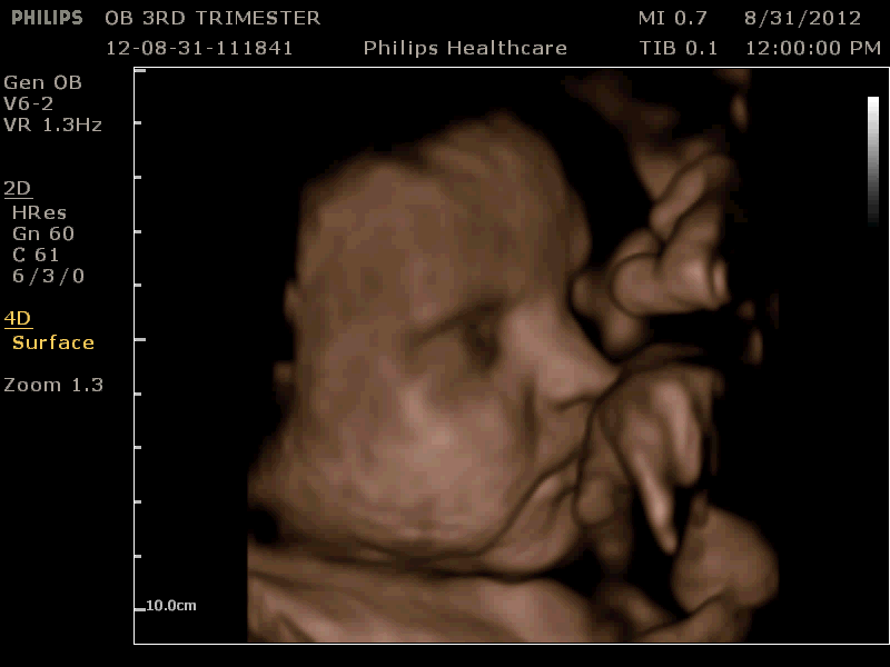 un primer plano de un beb&eacute;