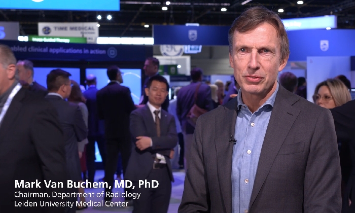 Optimice con inteligencia artificial