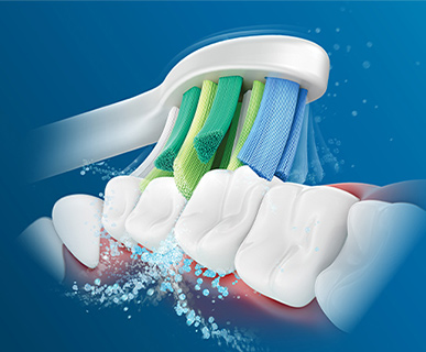 Evaluaci&oacute;n cl&iacute;nica del cabezal del cepillo Philips&nbsp;Sonicare&nbsp;InterCare